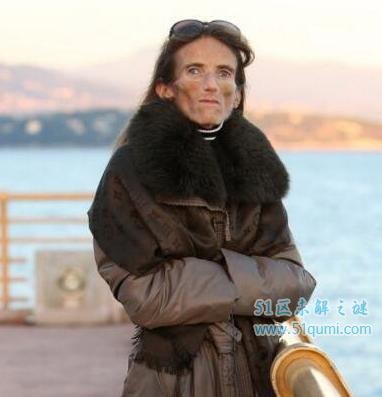 世界上最瘦的人，俄罗斯女孩Kseniya Bubenko只有20公斤