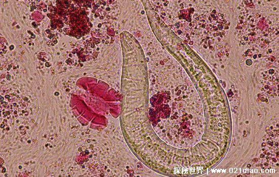 玉米男孩恐怖图片，皮肤被寄生虫感染（现实生活中真实存在）