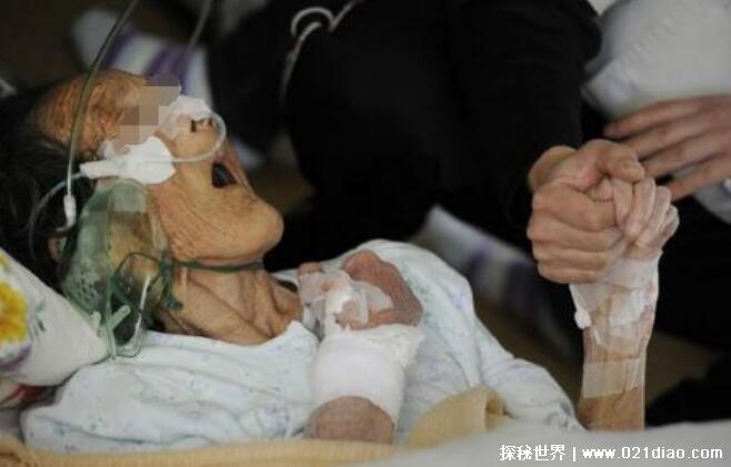 阳寿已尽的老人表现，15个征兆表明半年内阳寿将尽(喜欢掀被子)