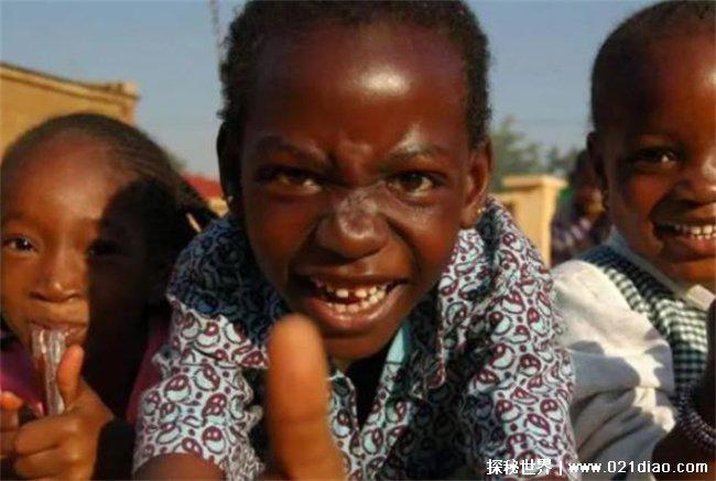 非洲象人族是真是假，假(自伪纪录片)