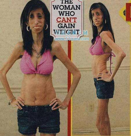 零脂肪女孩:丽兹·维拉斯奎兹 零脂肪女孩是什么病?