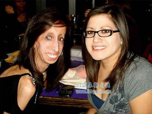 零脂肪女孩:丽兹·维拉斯奎兹 零脂肪女孩是什么病?