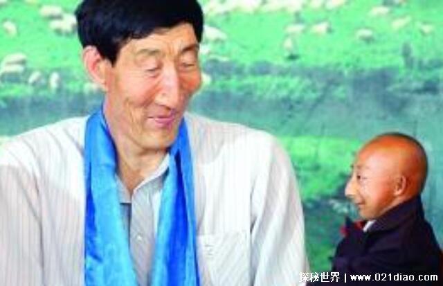 世界十大袖珍人排名,印度钱德拉第一(身高54.6厘米)