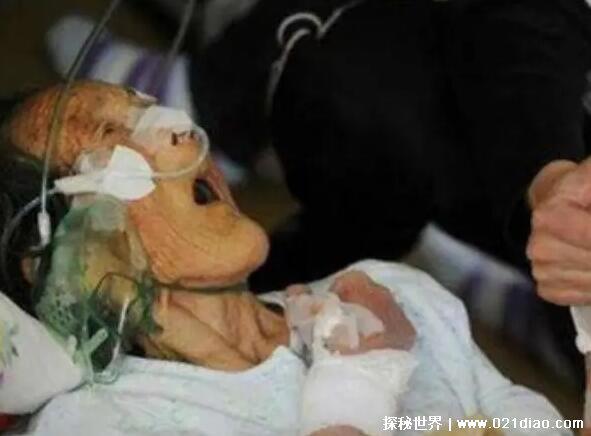 人断气的那一刻痛苦吗，痛苦只是程度不同(自然老死程度最轻)