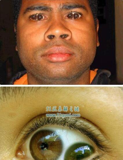 中国双瞳孔的人有谁?双瞳孔的人能看到什么?