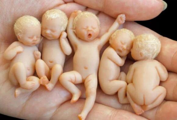 世界上最小的婴儿是谁，阿米利娅·泰勒(不到300克)