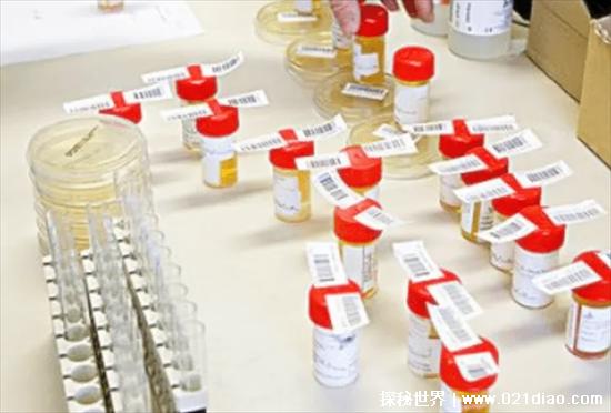 孕妇尿回收是干什么用的,验孕试纸还可以制药(网传12元每公斤)