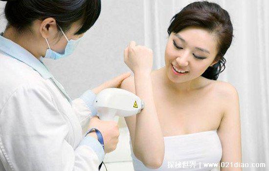 激光脱毛6年后后悔了，无法保证不重新长毛(有的还会形成黑斑)