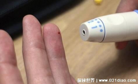 艾滋病自查的10个方法，在家里自诊的简单方法(检测试纸最好用)