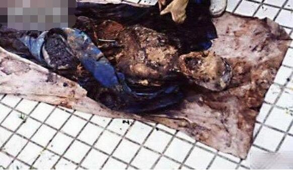 探索1995年成都僵尸事件真相，知情人称是狂犬病惹得祸