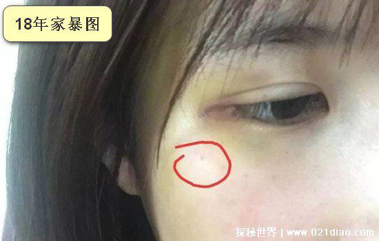 许凯家暴女朋友是真的吗，女方诬陷的(两张图片就可以看出)