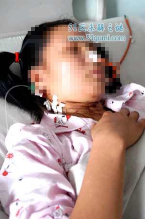 掏肠恶魔:新世纪最令人发指罪犯 直接从受害者体内拽出小肠