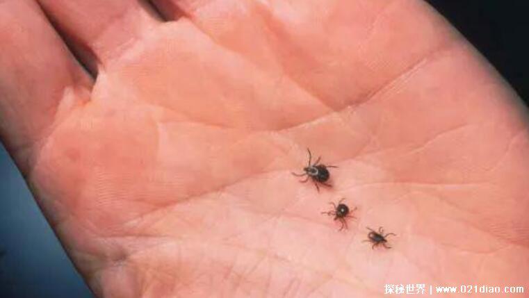 蜱虫咬人后的伤口图，教您如何应对蜱虫咬伤快速消灭蜱虫
