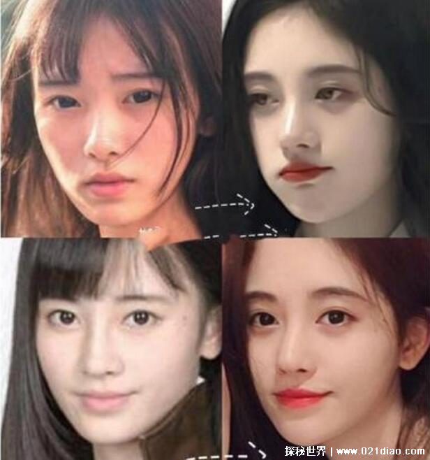 鞠婧祎整容前后对比判若两人，鞠婧祎出道前比赛照片曝光
