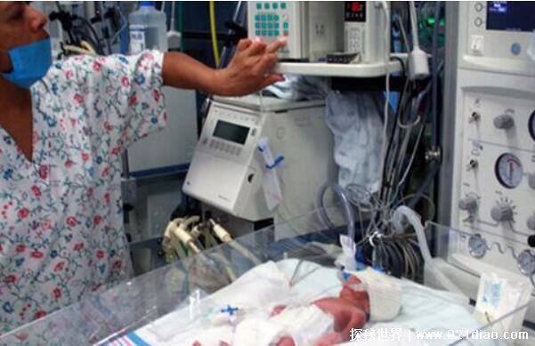 福岛核泄漏后变异女人，生出了辐射幽灵婴儿(长相惨不忍睹)