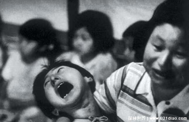 日本水俣病事件，工业污染导致的(数万人因此中毒)