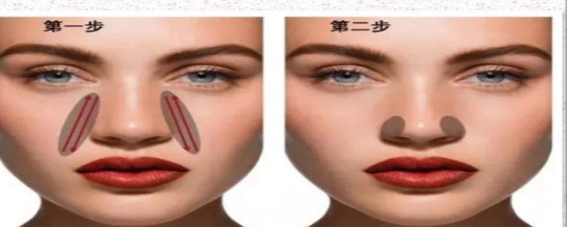 缩小鼻翼的方法