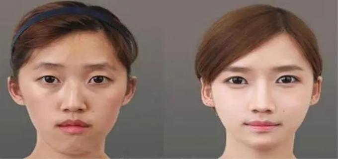 怎样变成瓜子脸