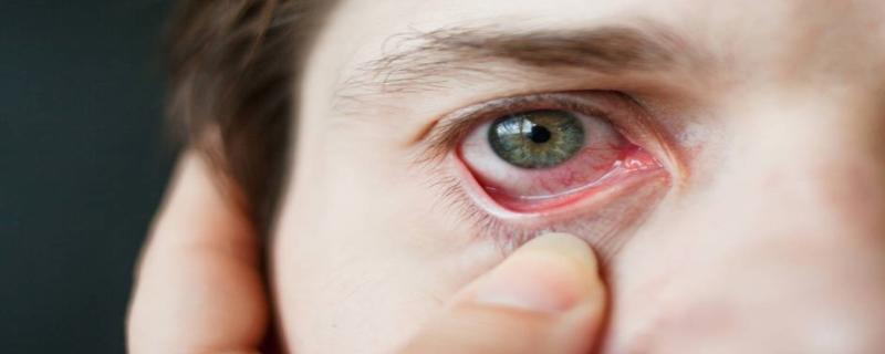 红色的眼睛是怎么回事