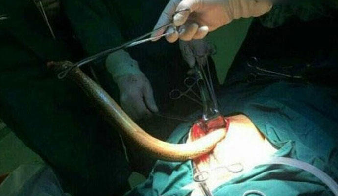 皮皮鳝我们走是什么梗 因为黄鳝女主播走红