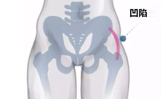 蝴蝶臀是什么意思，和蜜桃臀有什么区别