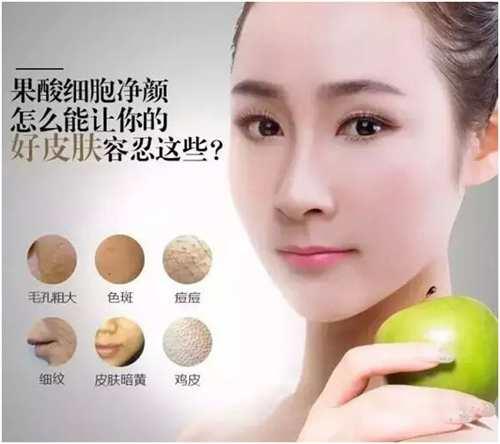 深圳祛痘哪家强 盘点前五名美容机构