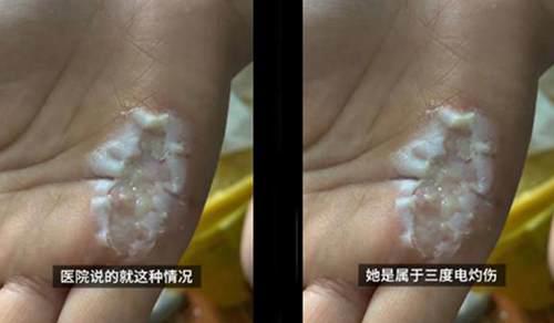 美的回应电晕女生