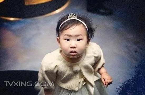 金喜善整容了吗？