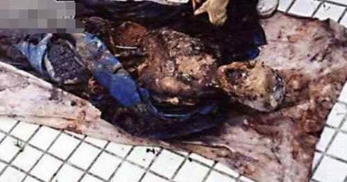 图说5个真实的僵尸事件