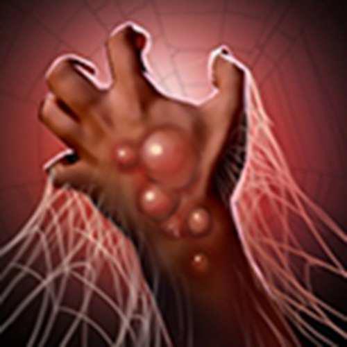 dotaomg全英雄模型技能浅析 育母蜘蛛