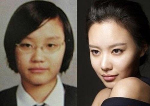 金雅中整容前对比照 金雅中现状如何