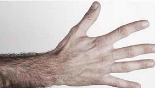 世界上体毛最多的女孩