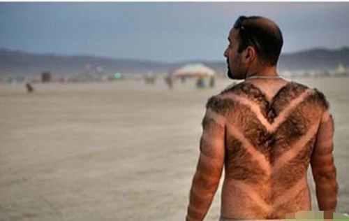 世界上体毛最多的女孩