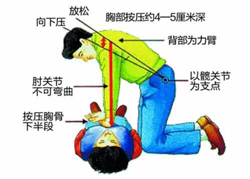 心肺复苏等急救知识将纳入学校教育内容