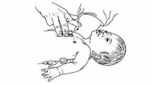 心肺复苏等急救知识将纳入学校教育内容
