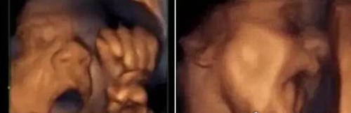 十大最搞笑诺贝尔奖