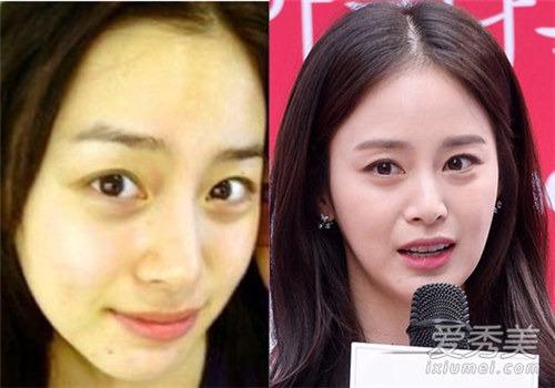 韩国没整容的明星你觉得有哪些