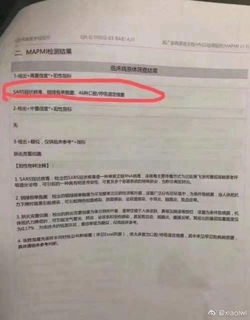 钟南山谈李文亮是英雄全面调查李文亮事件有何疑点武汉医生李文亮发布疫情被训始末