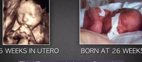 从佛角度告诉你堕胎的果报有多严重