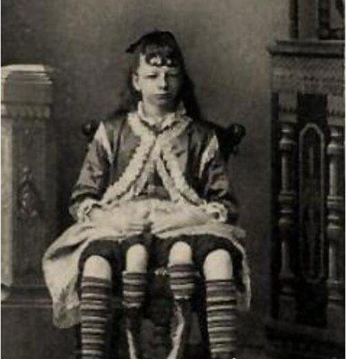 盘点世界十大变异人