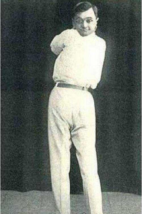 盘点世界十大变异人