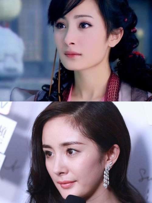 杨幂牙齿内倾的教训告诉你 拔牙并不能瘦脸