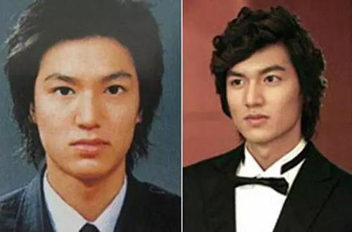 娱乐圈哪些男明星整过容