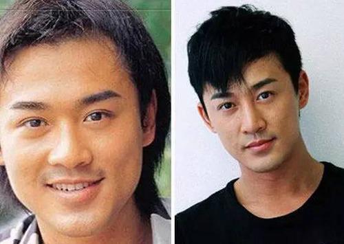 娱乐圈哪些男明星整过容