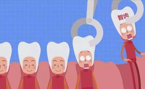 拔智齿后遗症太多了