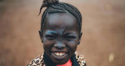 世界上最黑的孩子