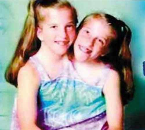 图说全球最奇特连体人