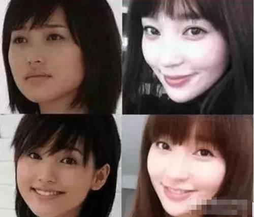 金莎整容了 力证自己只是做了 正骨 网友 隔着屏幕都觉得疼