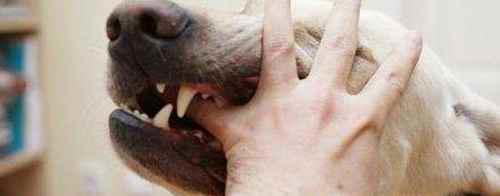 被狗狗咬出血了怎么办