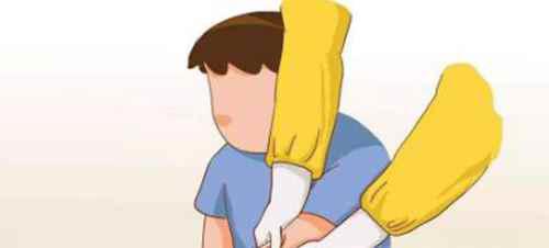 被狗狗咬出血了怎么办